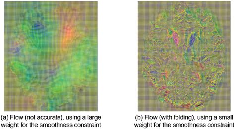 Figure 1 From Inverse Consistent Deep Networks For Unsupervised