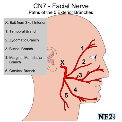 CN7 Facial Nerve Damage | Facial nerve, Facial nerve anatomy, Cranial ...