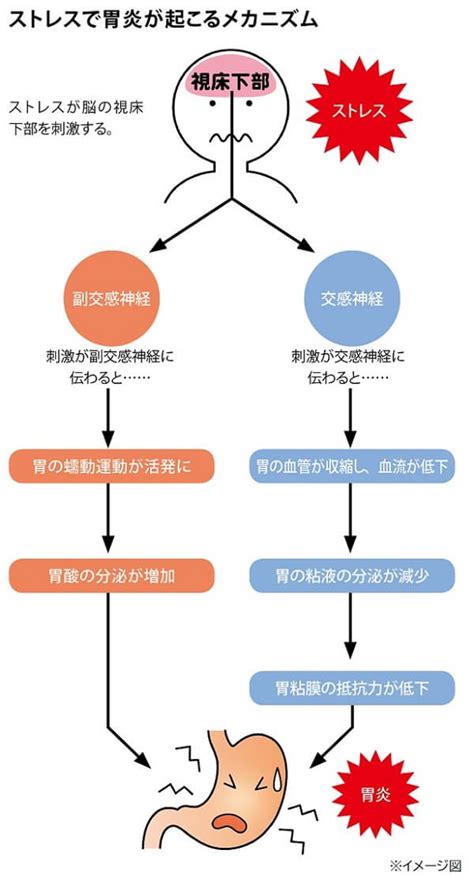 ストレスからくる食欲不振｜ 大正漢方胃腸薬 ｜ 大正製薬