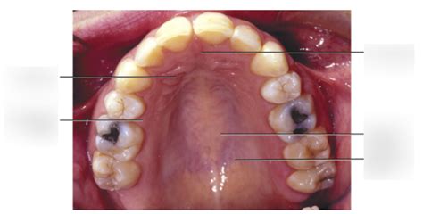 Chapter One Hard Palate Labeling Diagram Quizlet