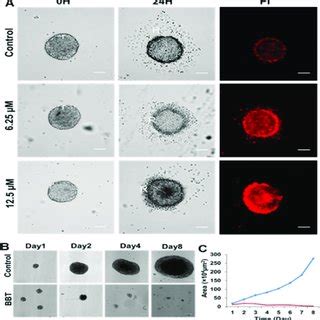 BBT Inhibits Both Migration And Growth Of Tumor Spheroid A