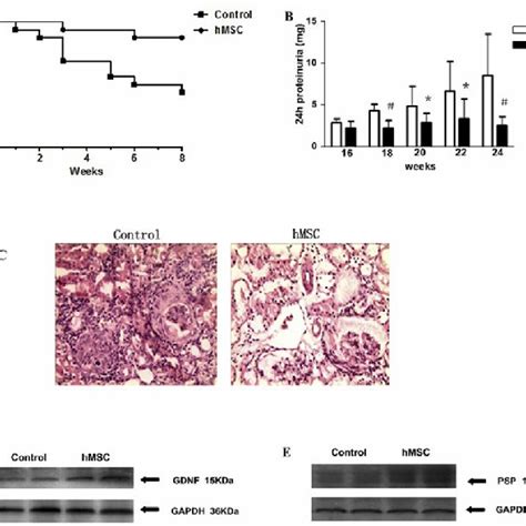 Hmsc Transplantation Alleviates Lupus Nephritis In Mrl Lpr Mice A