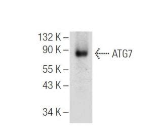 Atg Antibody B Western Blotting Image