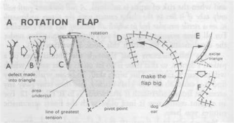 Basic Surgical Principles 364