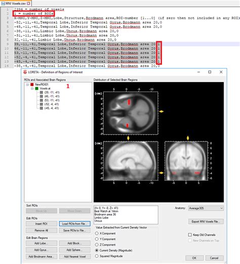 Brain Products Brainvision Analyzer A Guided Tour Through Loreta