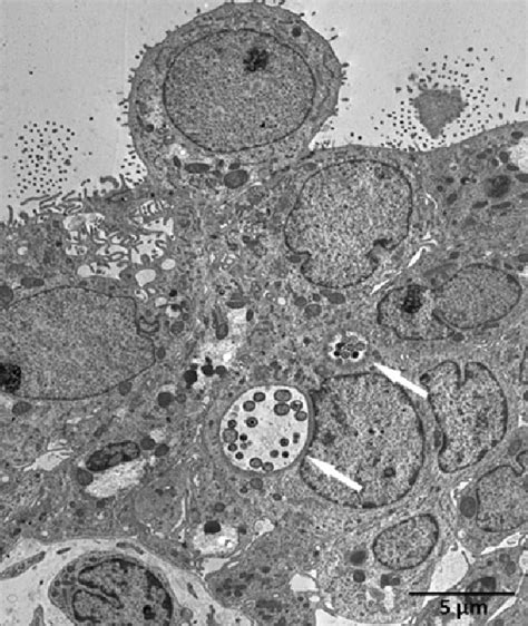 Chlamydia Trachomatis Microscopy