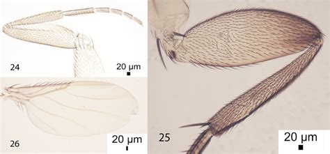 Megaselia Caveonectergata Sp N Male 24 Front Leg 25 Hind Femur And