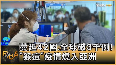 蔓延42國全球破3千例「猴痘」疫情燒入亞洲｜方念華｜focus全球新聞 20220623 Youtube