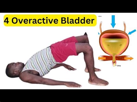 Kegels Exercises For An Overactive Bladder Youtube