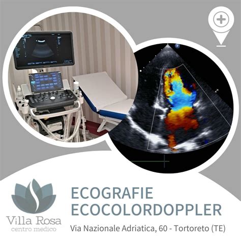 Ecografia Ecocolordoppler Villa Rosa