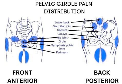 Pregnancy Related Pelvic Girdle Pain The Body Refinery