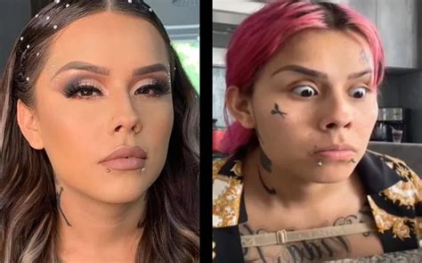 Yeri Mua Mona y Karely Ruiz Antes y después de las cirugías FOTOS