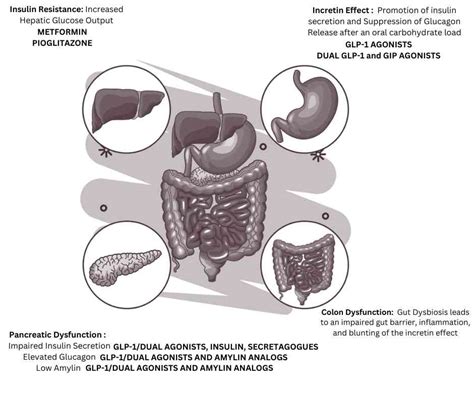 Egregious Eleven of Type 2 Diabetes Mellitus – My Endo Consult