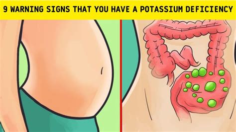 9 Warning Signs That You Have A Potassium Deficiency Youtube