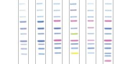 Western blot protein ladder bio rad - monsterdolf