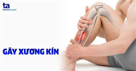 Tiết lộ gay kín là gì và những thông tin thú vị xung quanh chủ đề này