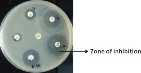 Antibiotic Susceptibility Test Clear Zones Around The Bacterial Colony