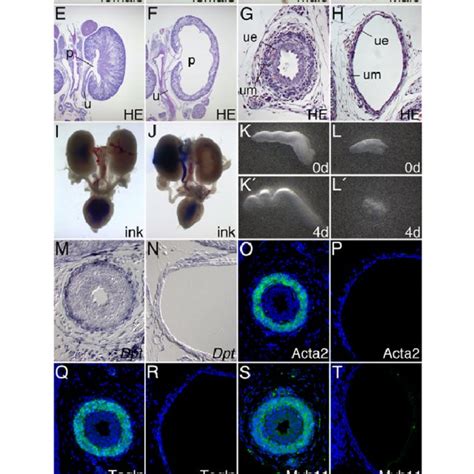 Kidney And Urogenital Tract Anomalies In Tbx Cre Ctnnb Fx Fx