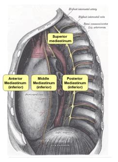 Bronchogenic Cyst Medlibes Online Medical Library