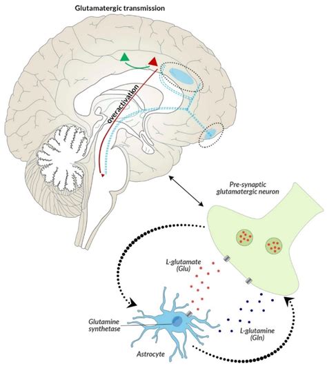 Schizophrenia Brain Ventricles