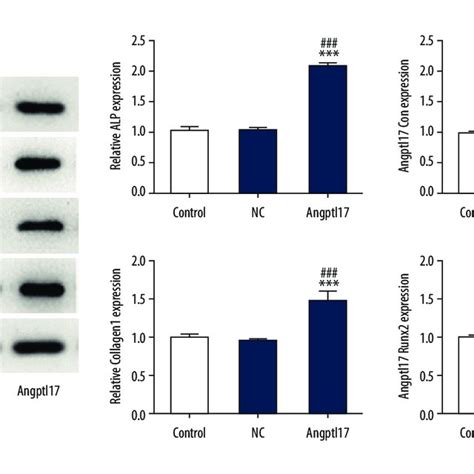 The Overexpressed Plasmid Of ANGPTL7 PMSCV ANGPTL7 Was Transfected Into