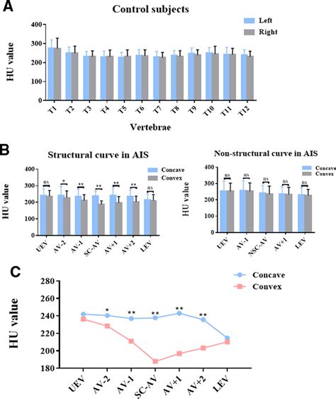 Asymmetrical changes in vertebral-body bone quality in AIS patients.... | Download Scientific ...