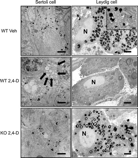 Electron Microscopic Evaluation Of Sertoli Cells And Leydig Cells The