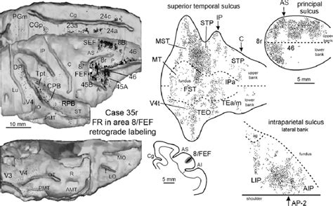 Distribution Of The Retrograde Labeling Observed Following An Injection