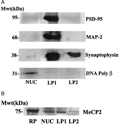 Methyl Cpg Binding Protein 2 Mecp2 Immunoreactivity In Human Frontal