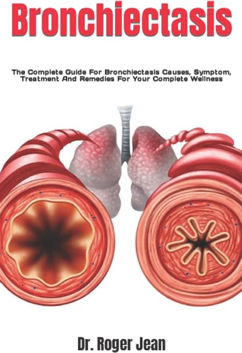 Bronchiectasis A Comprehensive Guide To Diagnosis And Management Ask