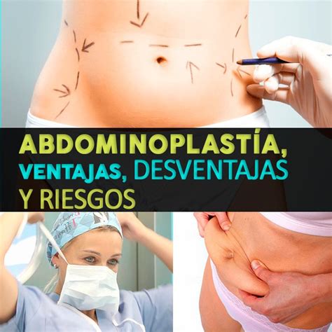 Abdominoplastia Ventajas Desventajas Y Riesgos La Gu A De Las Vitaminas