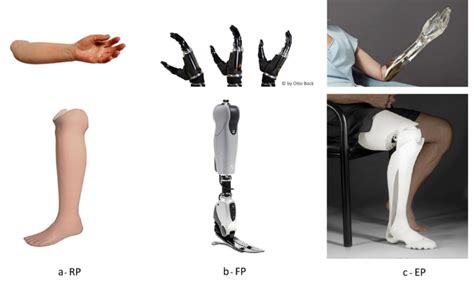 A Above Realistic Prosthetic Limb For Upper Limb Loss Made Of