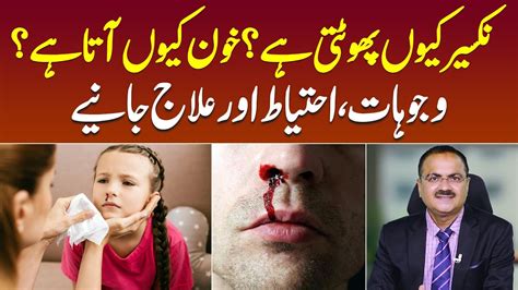 Nakseer Ka Ilaj Naak Se Khoon Aane Ka Ilaj Nose Bleeding Causes