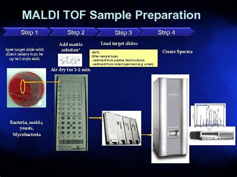 Maldi Tof Matrix Assisted Laser Desorption Ionization Time