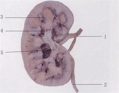 图6 6 肾脏 剖面观1 基础医学 医学