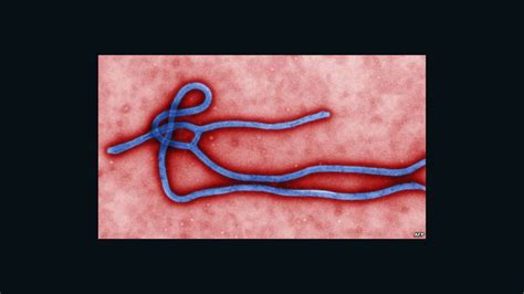 Ebola Vaccine Tests Planned Soon Nih Says Cnn