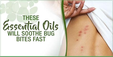 These Essential Oils Will Soothe Bug Bites Fast Essential Oils Us