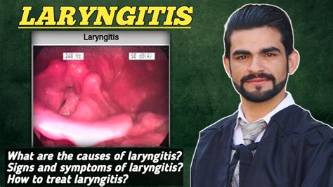 Laryngitis Laryngitis Causes Treatment Signs And Symptoms Youtube