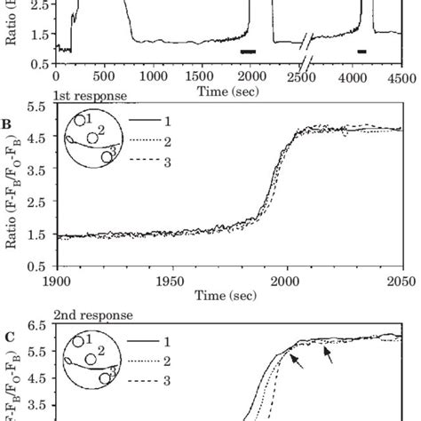 Schematic Illustration Of The Icsi Procedure Pb First Polar Body Zp