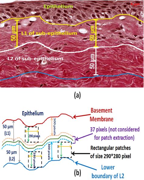 Figure 1 From Multifractal Alterations In Oral Sub Epithelial