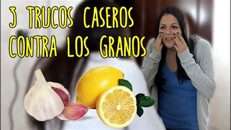 3 Remedios Caseros Contra Los Granos YouTube