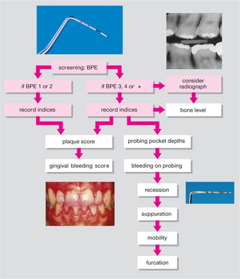 8 Principles And Phases Of Treatment Pocket Dentistry