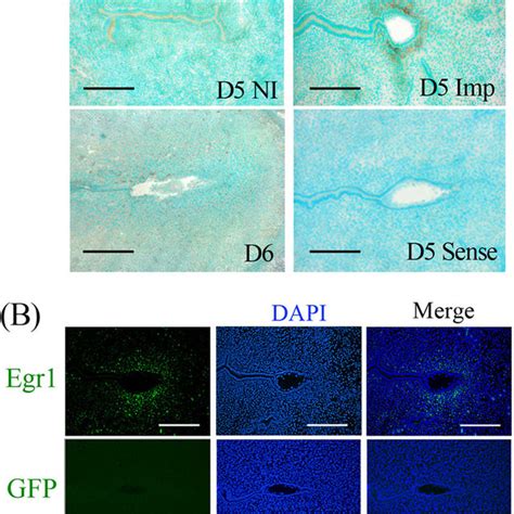 Spatiotemporal Expressions Of Egr Mrna And Protein In Mouse Uterus