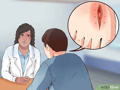 How to Remove Stitches: 15 Steps (with Pictures) - wikiHow