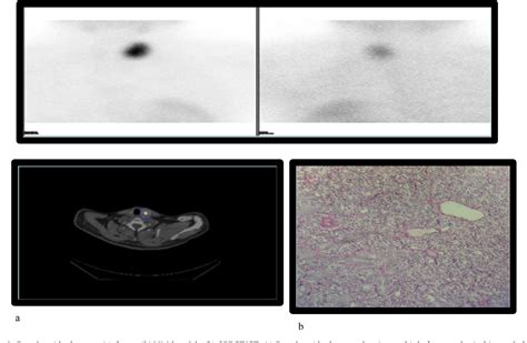 Figure 3 From Role Of Different Imaging Modalities And Fnac Correlation In Role Of Different