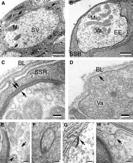 Transmission electron microscopy of synaptic boutons on DLM from flies... | Download Scientific ...