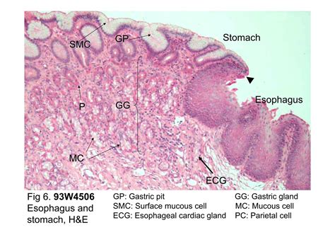 Esophagus Stomach Junction Histology Labeled