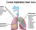 Lab Abnormalities In Respiratory Disorders Flashcards Quizlet