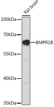 bmprb antibody anti bmprb stjohnslabs