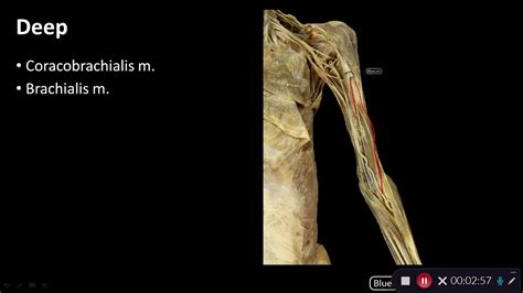 Anterior Compartment Of Arm Overview Of Upper Limb Dissection